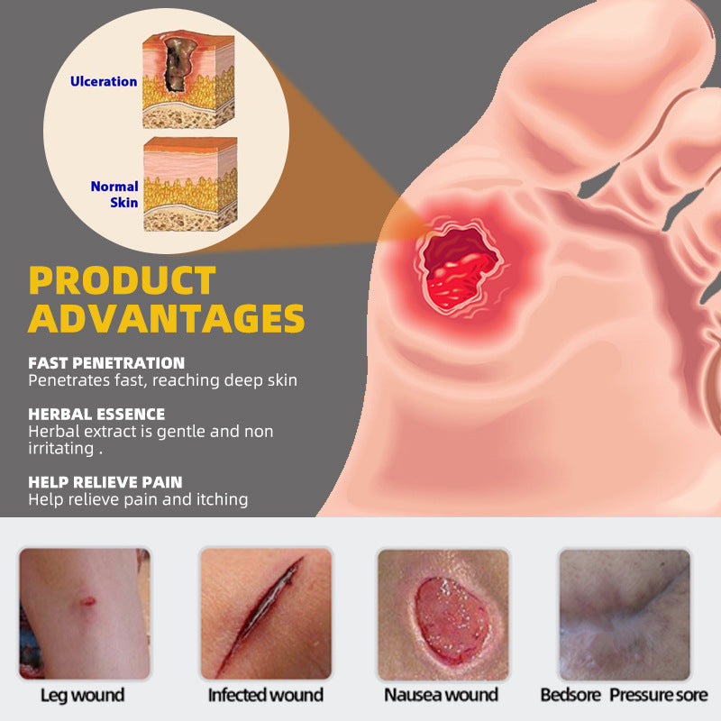 sumifun aliexpress amazon temu cross-border bedsore body cream bedsore care elderly health K10110