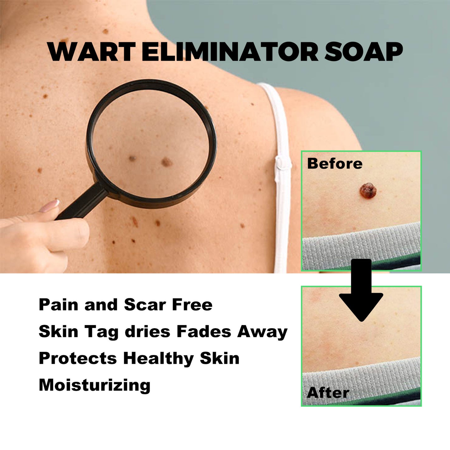 South Moon Anti-wart Soap Mole and wart removal Face and neck fleshy filamentous warts Body cleansing soap