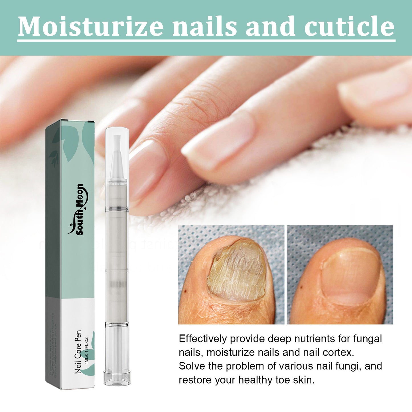 South moon nail repair pen nail remover dead skin barbs onychomycosis care nutrition moisturizing repair pen