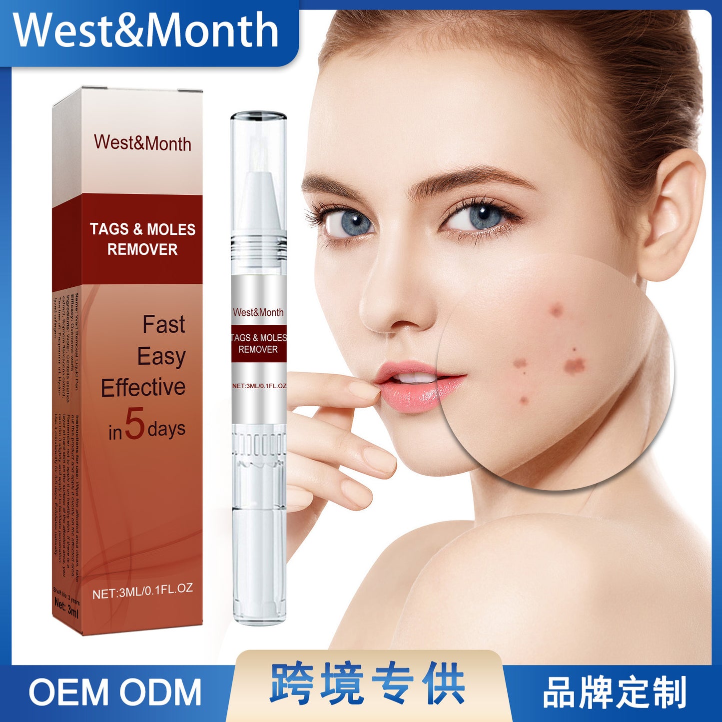 West&Month wart removal pen repairs moles, fleshy grains, skin tags, flat and smooth skin wart removal liquid pen