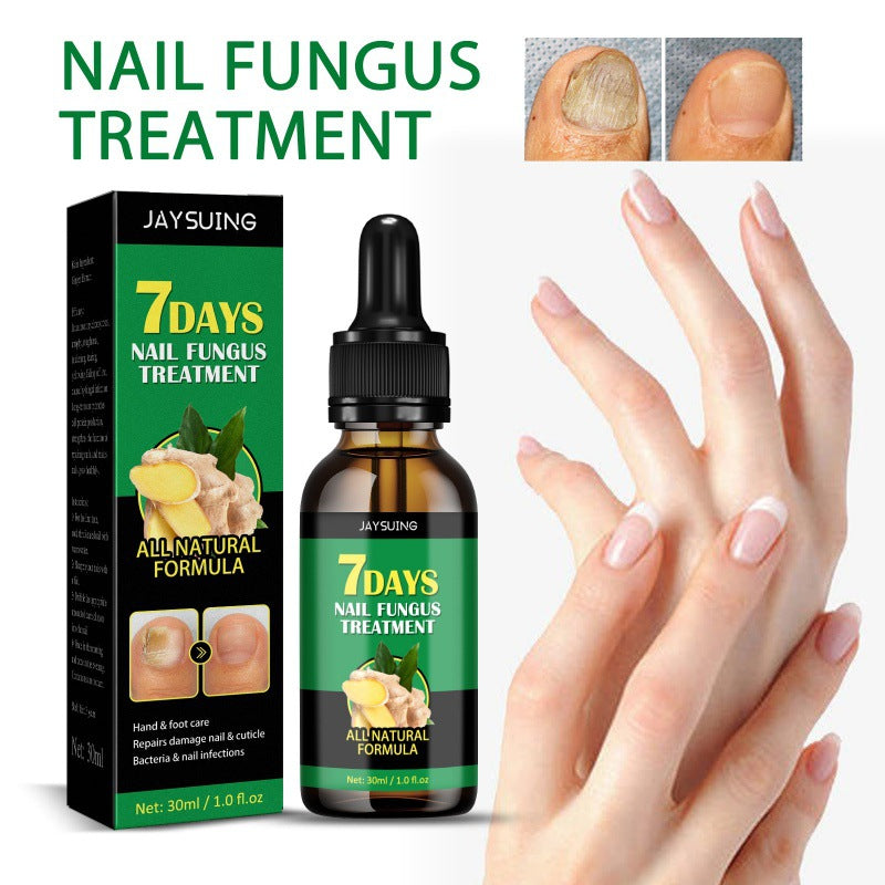 Ginger nail care liquid onychomycosis repair hand and foot nail care soft nail brightening moisturizing liquid