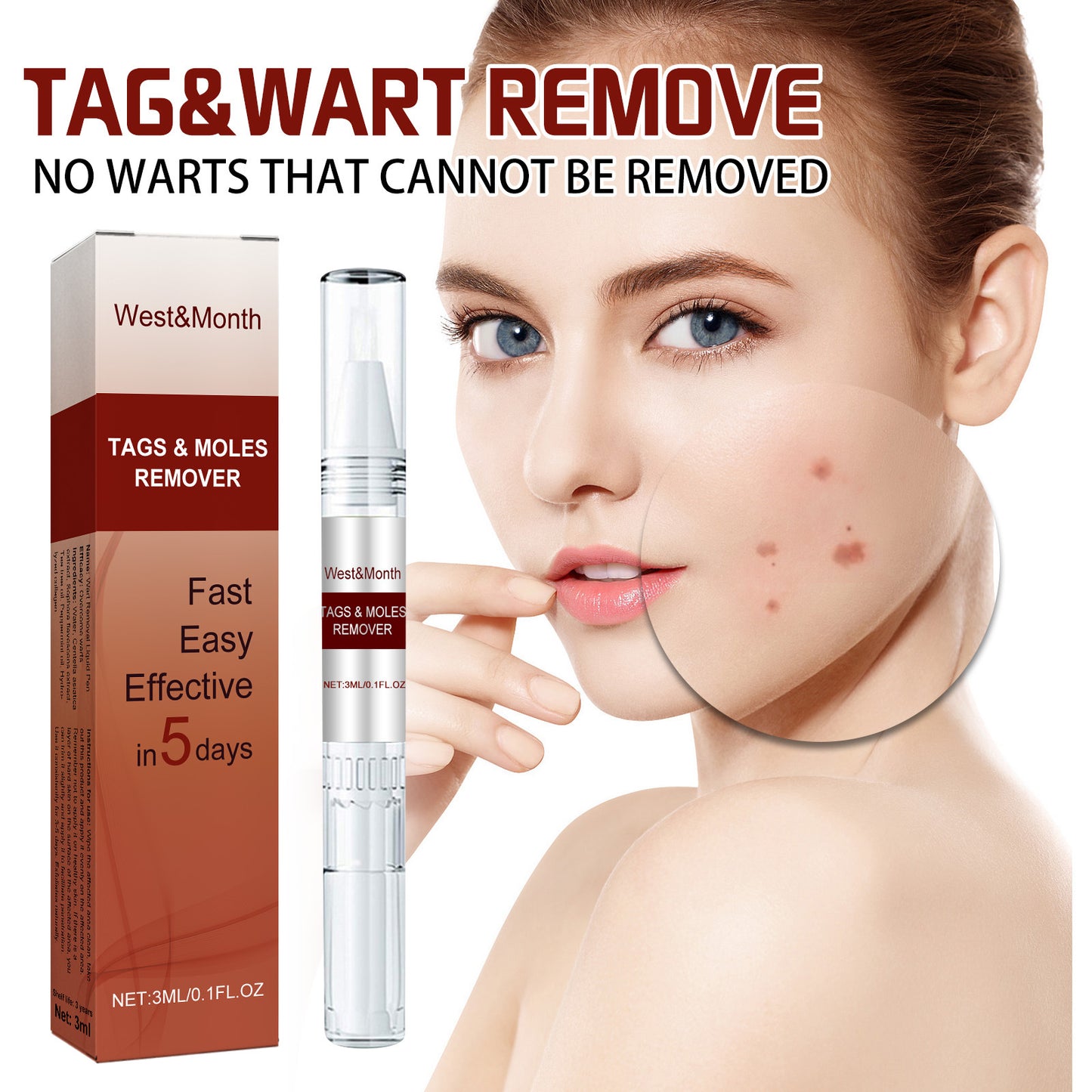 West&Month wart removal pen repairs moles, fleshy grains, skin tags, flat and smooth skin wart removal liquid pen