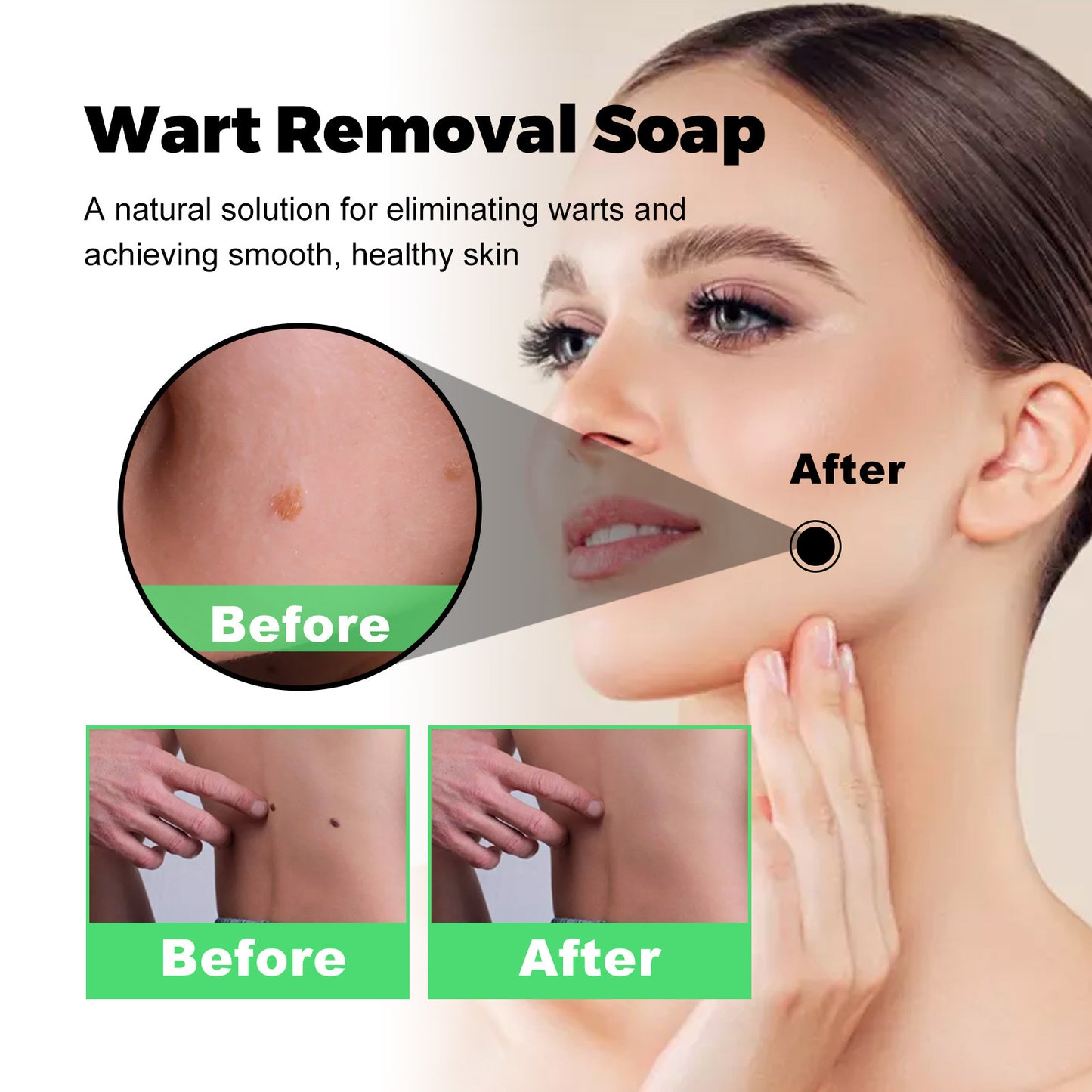 South Moon Anti-wart Soap Mole and wart removal Face and neck fleshy filamentous warts Body cleansing soap