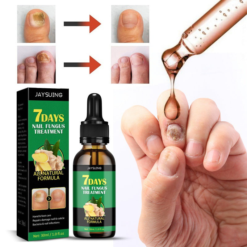 Ginger nail care liquid onychomycosis repair hand and foot nail care soft nail brightening moisturizing liquid