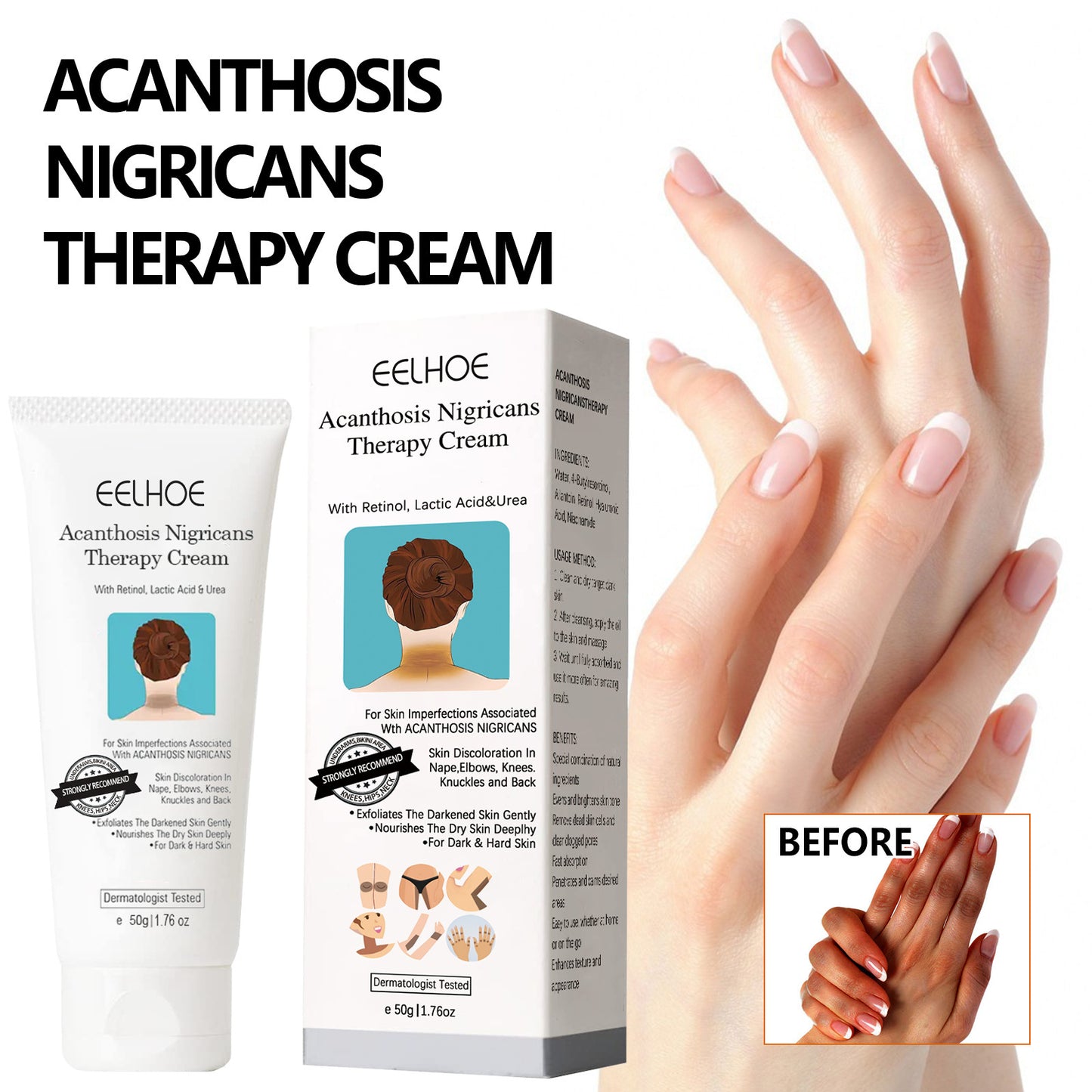 EELHOE Black Acanthosis Repair Cream Armpit Arm Knee Joint Black Moisturizing Whitening Repair Body Care Cream