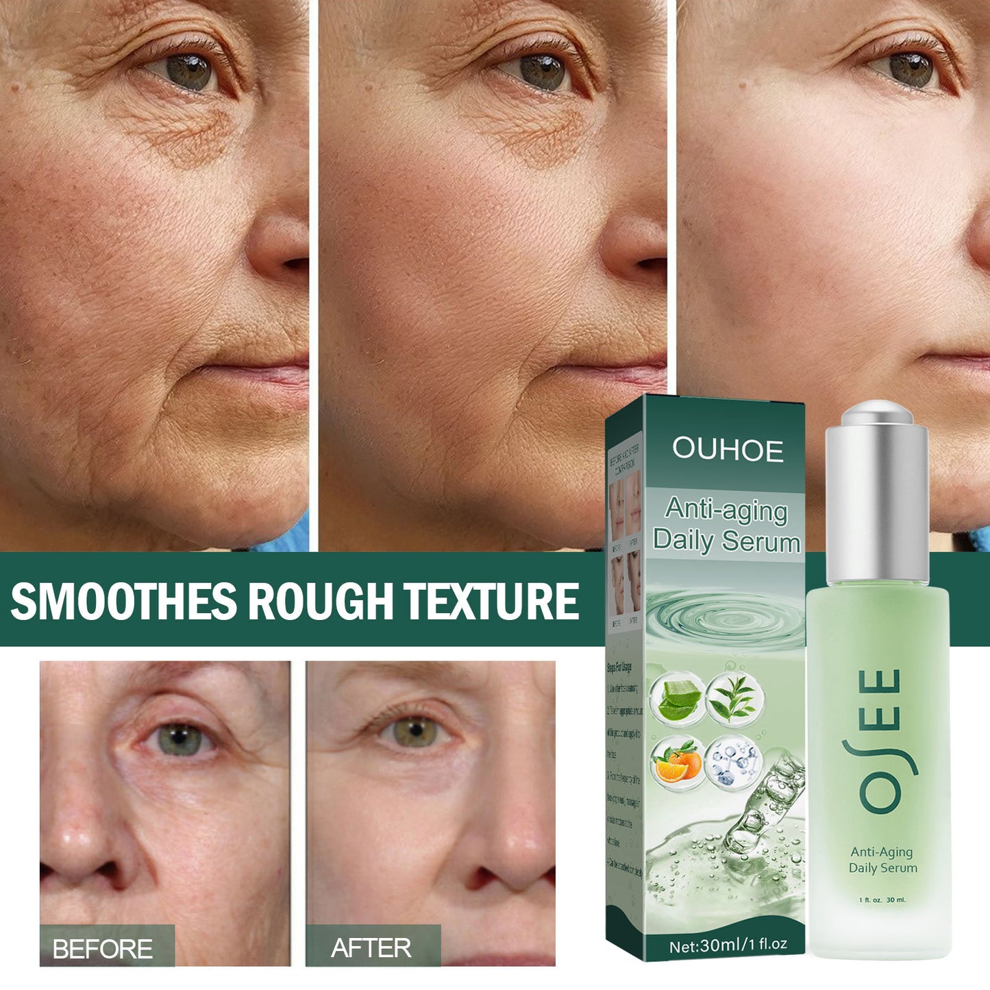 OUHOE deep anti-wrinkle essence fades fine lines around the eyes, nasolabial folds, moisturizes, tightens, rejuvenates and brightens skin tone