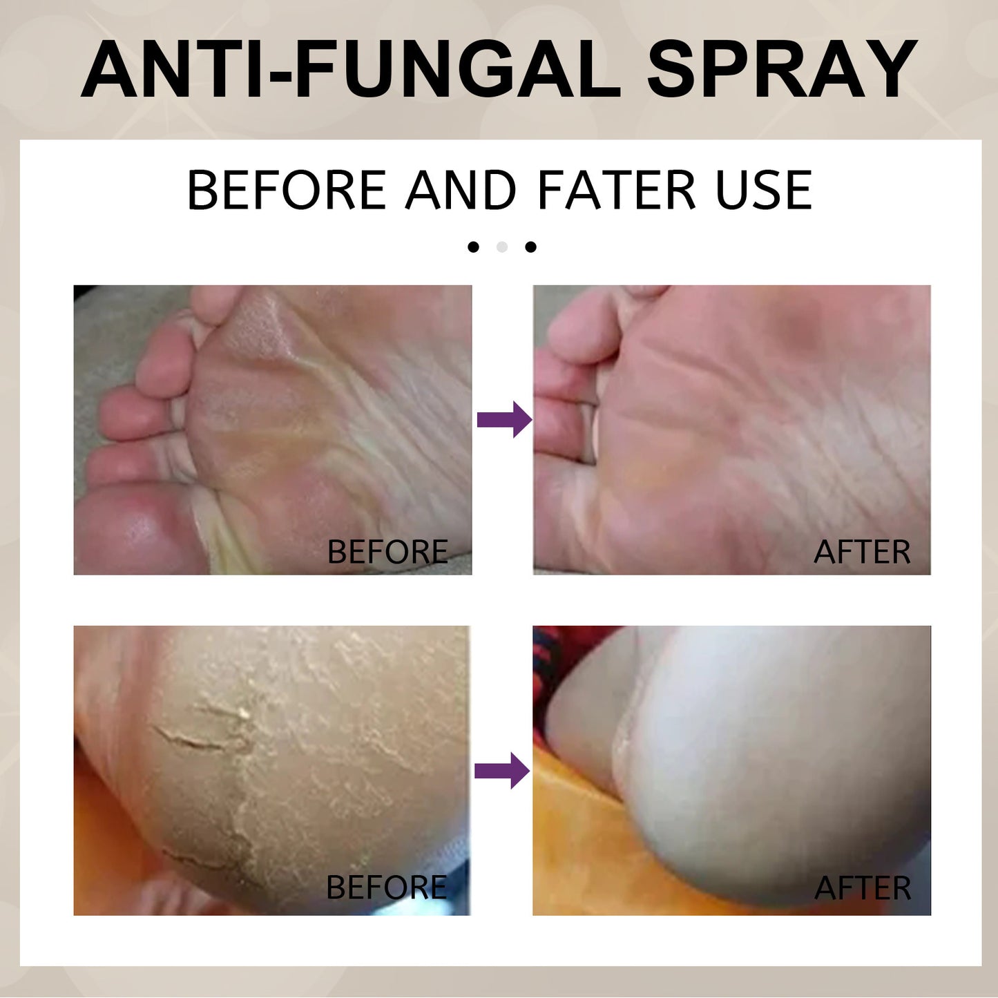 Foot spray moisturizes the skin, exfoliates, prevents itching, dry and cracked foot skin, stops sweating and removes foot odor